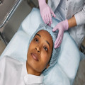 Welke cosmetische ingrepen worden vergoed in Nederland?